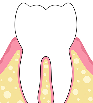 정상