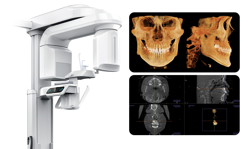 3D CT 진단