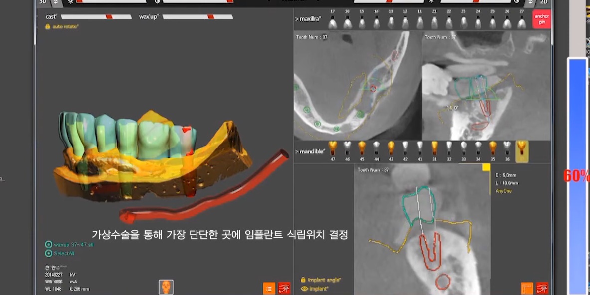 가상 시뮬레이션